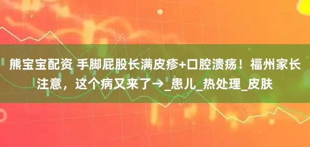 熊宝宝配资 手脚屁股长满皮疹+口腔溃疡！福州家长注意，这个病又来了→_患儿_热处理_皮肤